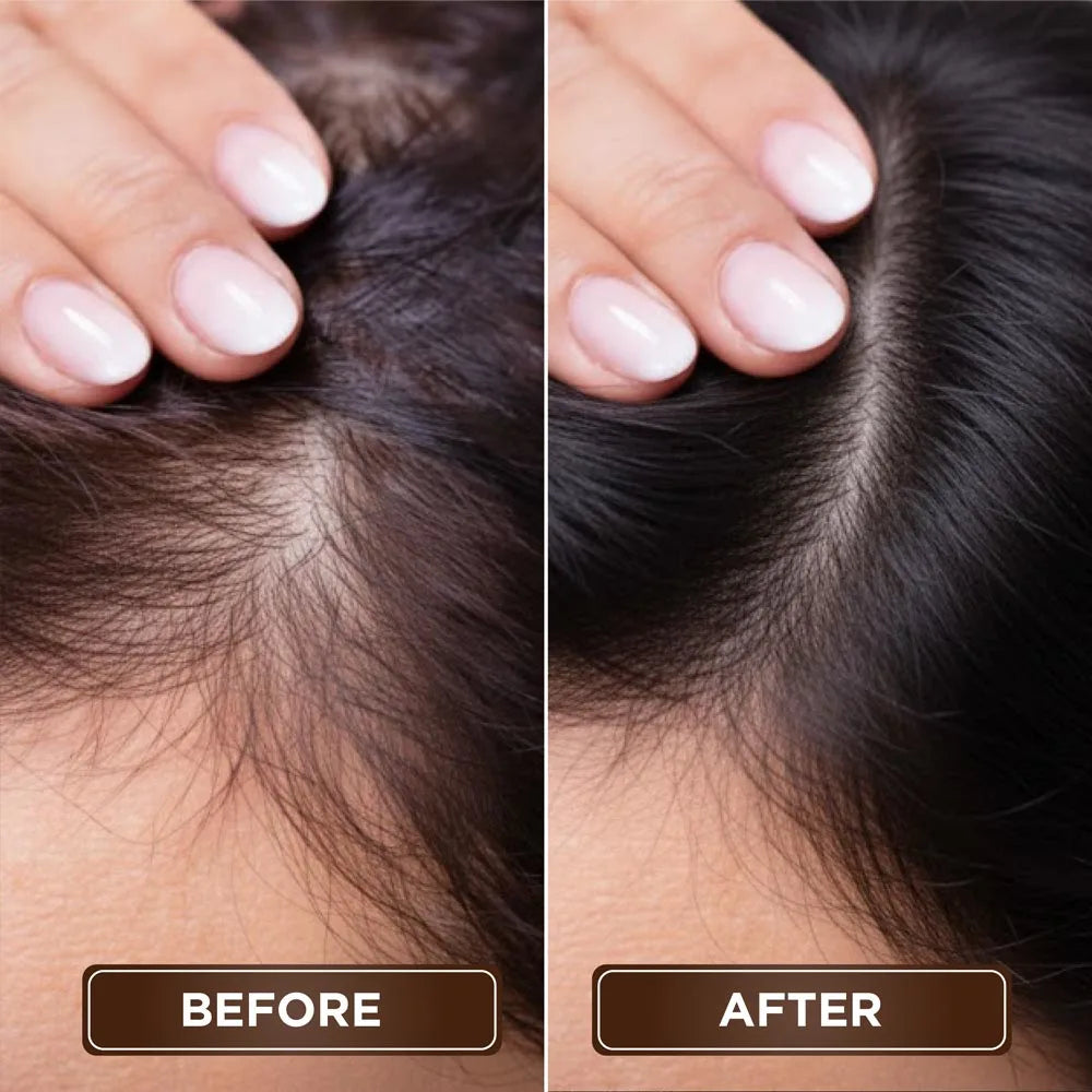 Before After Results 